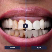 Last inn bildet i Galleri-visningsprogrammet, OrthoVivid 2.0